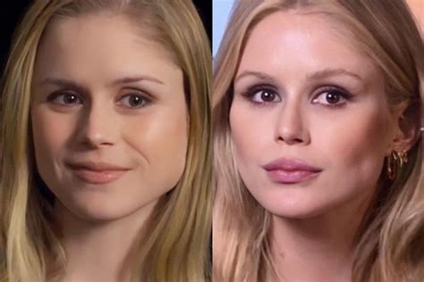 erin moriarty before surgery|Erin Moriarty Plastic Surgery: Anatomy of a Change in Hollywood